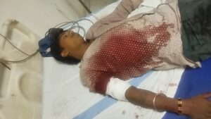 बाइक सवार तीन अपराधियों ने दो युवकाें पर बरसाईं गोलियां, पटना रेफर